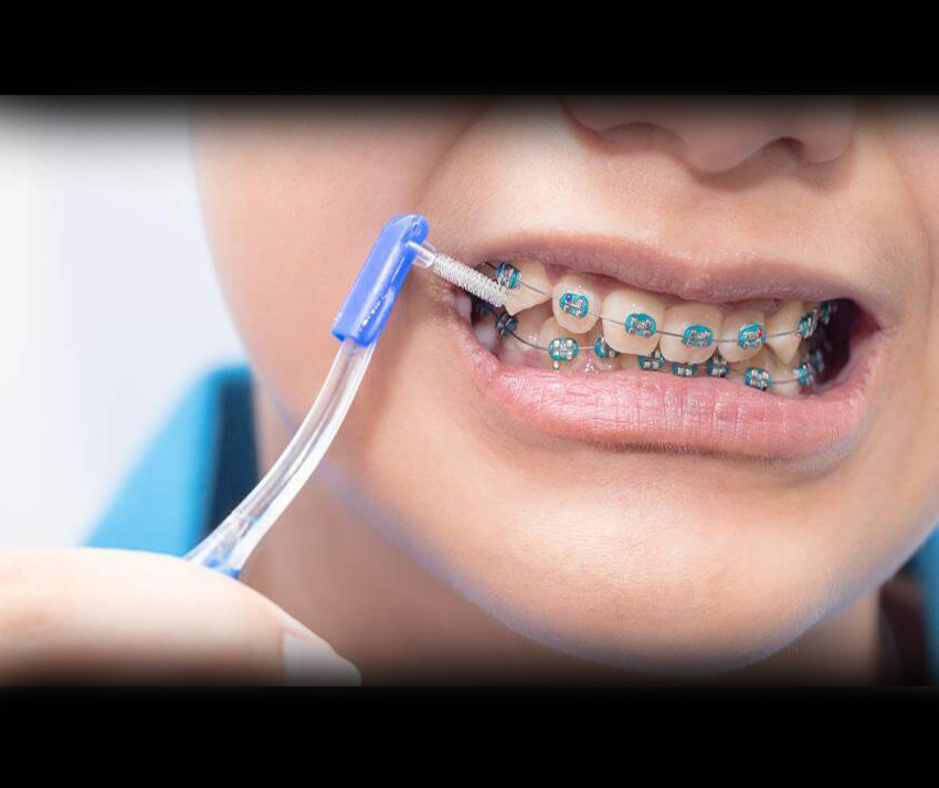 ارتودنسی در کلینیک دندانپزشکی ریحانه